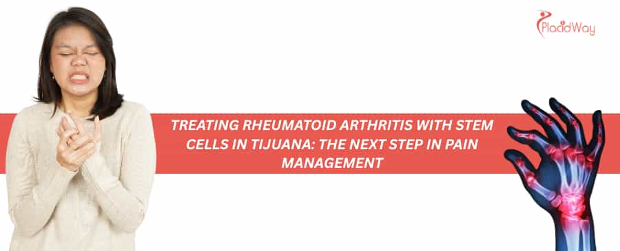 Tratamiento de la artritis reumatoide con células madre en Tijuana