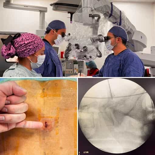 Spine and Neurosurgery Mexico City - CICOVE