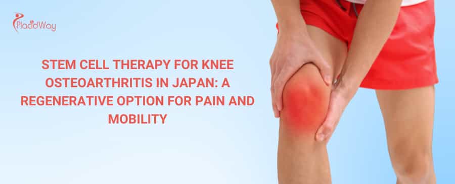 Stem Cell Therapy for Knee Osteoarthritis in Japan