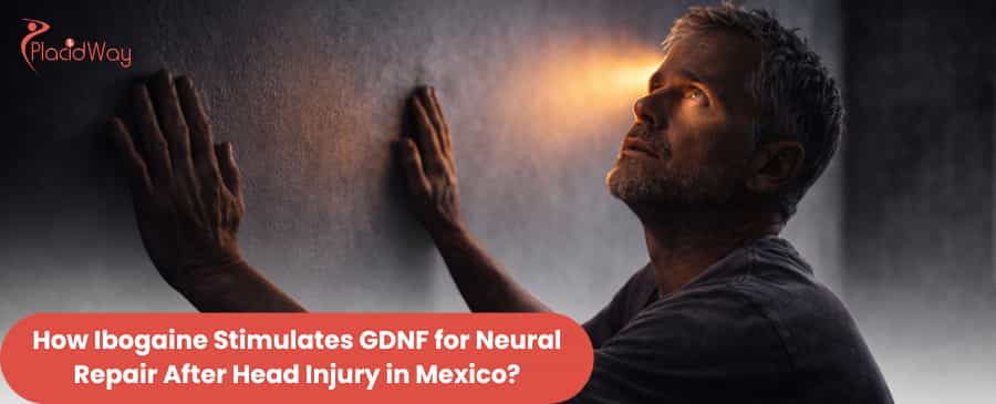 Ibogaine treatment in Mexico