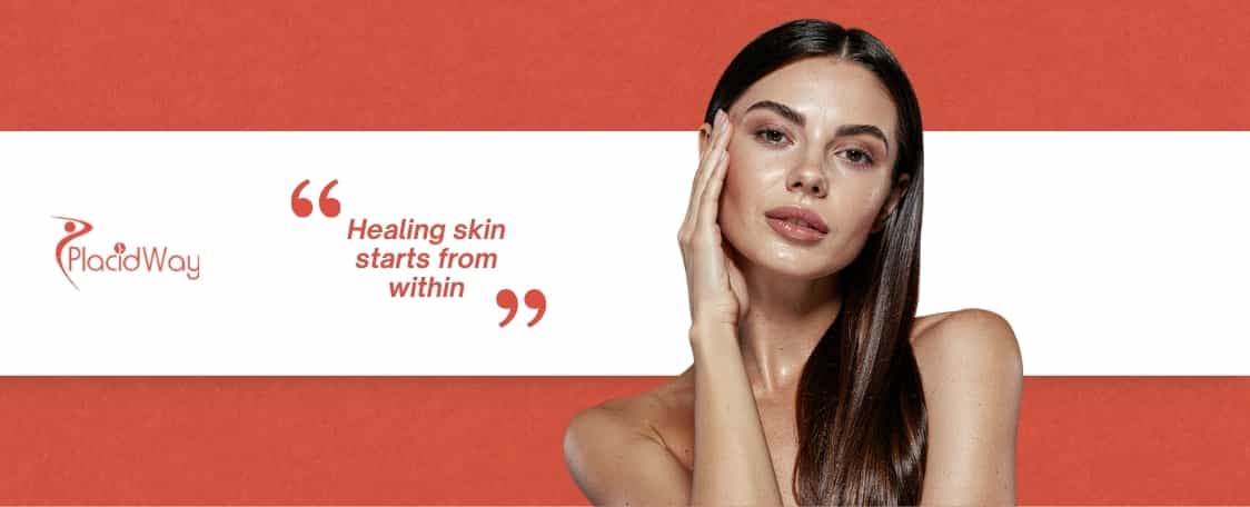 Can Stem Cell Therapy Help Psoriasis in Tijuana?