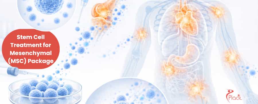 Stem Cell Treatment for Mesenchymal (MSC) 