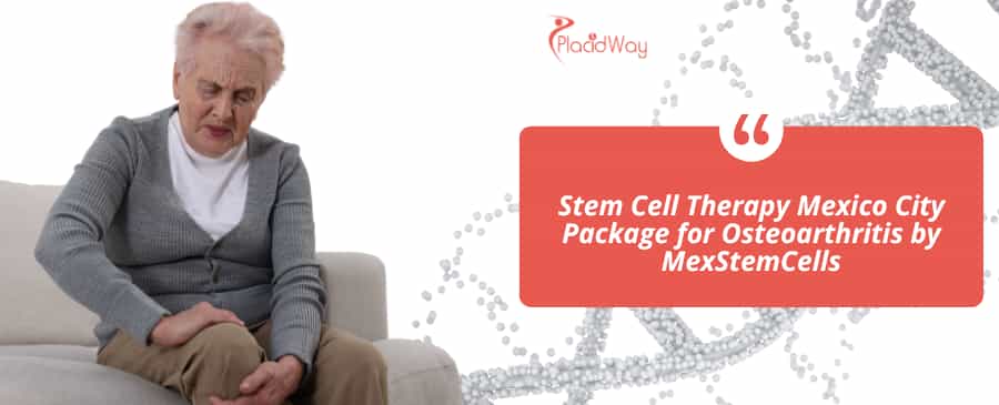 Paquete de terapia con células madre para la osteoartritis en la Ciudad de México, ofrecido por MexStemCells.