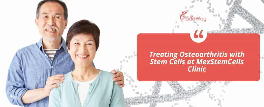 Treating Osteoarthritis with Stem Cells at MexStemCells Clinic