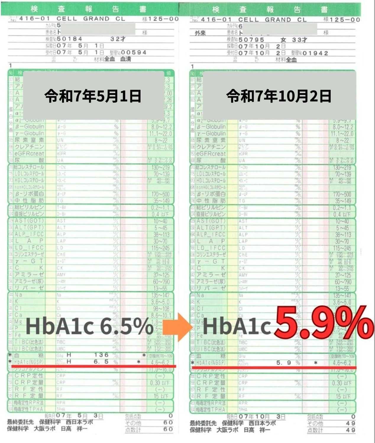 صور قبل وبعد: العلاج بالخلايا الجذعية لمرض السكري في اليابان