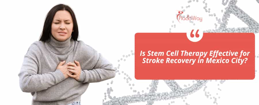 Is Stem Cell Therapy Effective for Stroke Recovery in Mexico City?