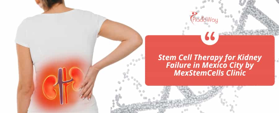 Terapia con células madre para la insuficiencia renal en la Ciudad de México por la Clínica MexStemCells