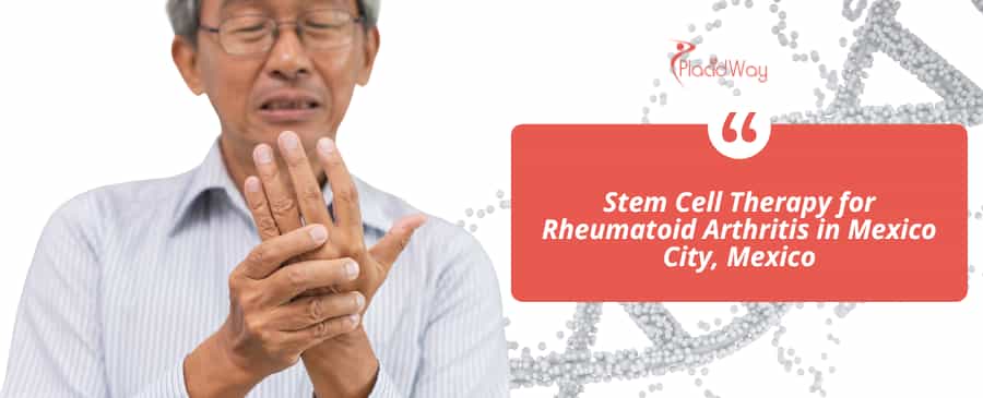 Stammzellentherapie bei rheumatoider Arthritis in Mexiko-Stadt, Mexiko
