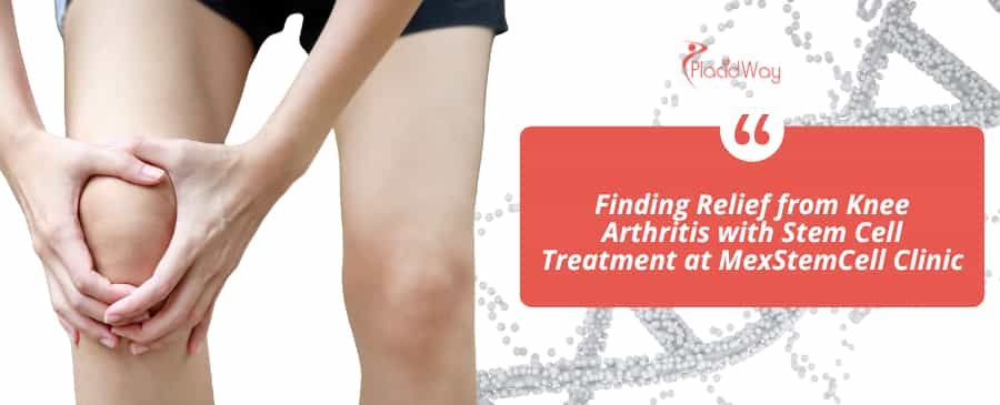 https://www.placidway.com/article/3815/stem-cell-therapy-for-knee-arthritis-in-mexico-city-mexico
