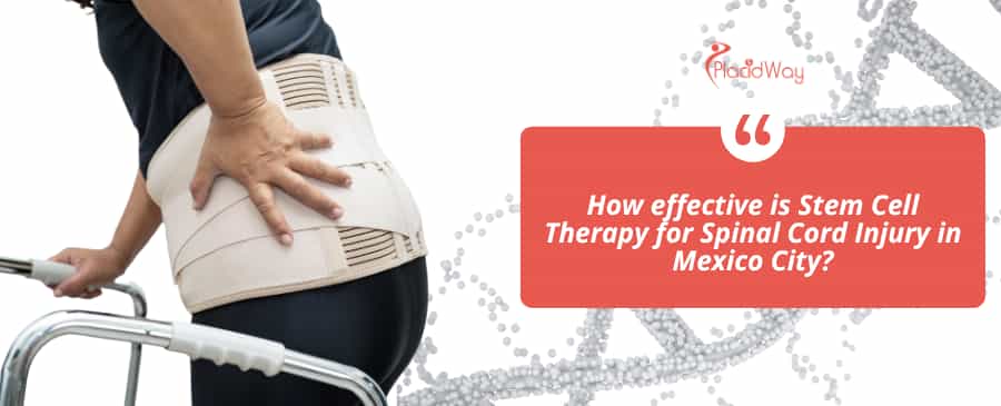 ¿Qué tan efectiva es la terapia con células madre para las lesiones de la médula espinal en la Ciudad de México?