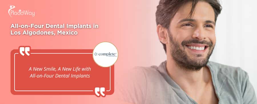 All-on-Four Dental Implants in Los Algodones Mexico by Complete Advanced Dentistry