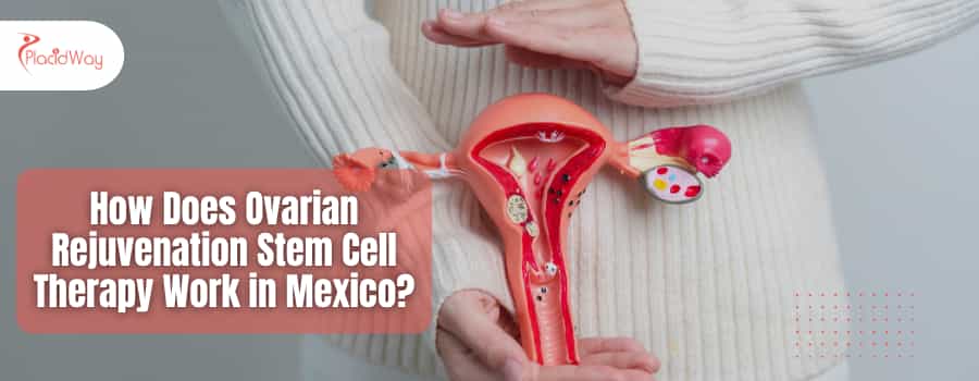 How Does Ovarian Rejuvenation Stem Cell Therapy Work in Mexico?
