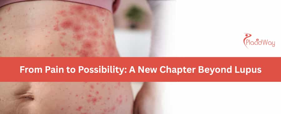 Lupus No More: How Canadians Are Reversing Symptoms with Stem Cells in Guadalajara