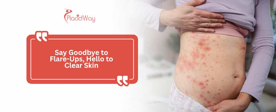 Clear Skin Awaits: U.S. Psoriasis Patients Are Finding Real Relief in Mexico’s Stem Cell Clinics