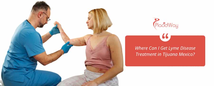 Doctor examining Lyme disease patient with rash