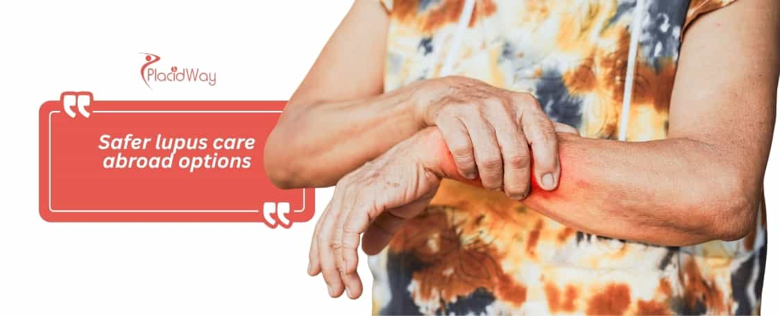 Stem Cell Therapy for Lupus in Mexico 