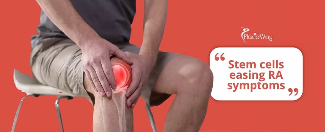 stem cell therapy for rheumatoid arthritis in Mexico