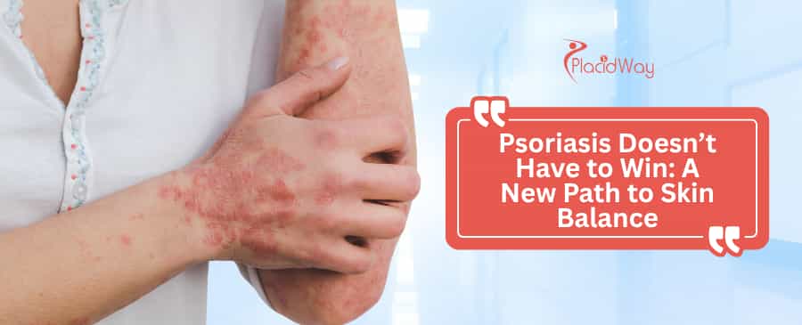 Psoriasis Doesn’t Have to Win: Why Americans Are Turning to Immune-Level Strategies in Mexico for Skin Balance