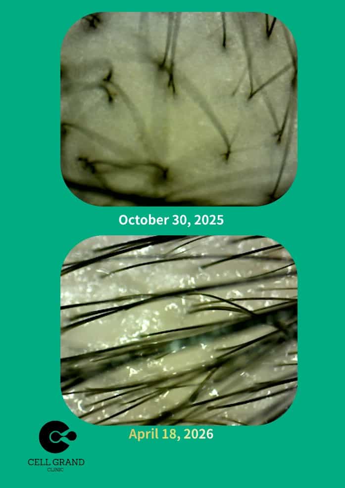 regenerative medicine in Japan