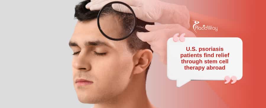 Smooth Skin Awaits: U.S. Psoriasis Patients Are Finding Real Relief in Puerto Vallarta with Stem Cells!