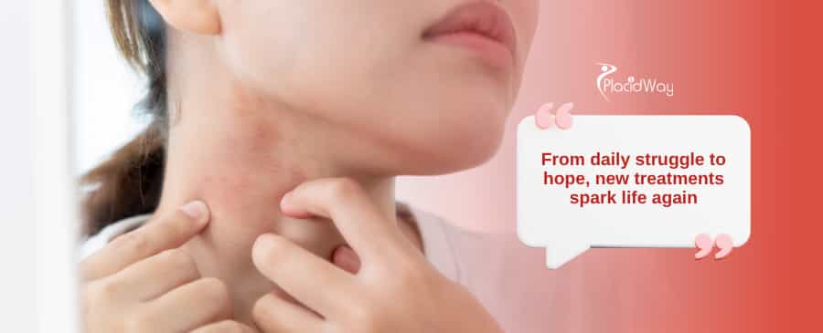 Lupus? Stem Cells in Mexico Are Helping U.S. Patients Turn Their Lives Around!