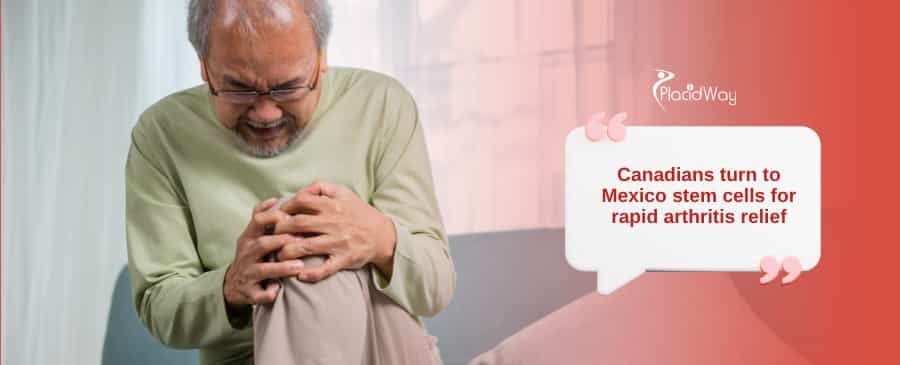 No More Joint Pain: Canadians Are Turning to Stem Cells in Mexico for Fast Arthritis Relief!