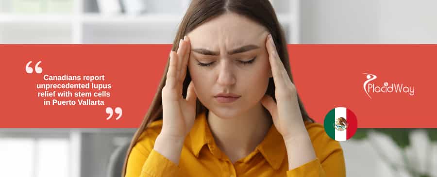 Canadians Are Finding Lupus Relief Like Never Before with Stem Cells in Puerto Vallarta!