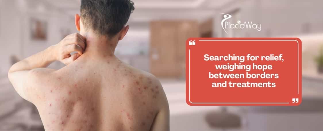 Guadalajara Stem Cells vs. Canadian Biologics: Which is Better for Psoriasis Relief?