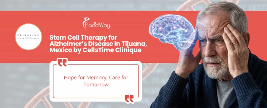 Stem Cell Therapy for Alzheimer’s Disease in Tijuana Mexico by CellsTime Clinique