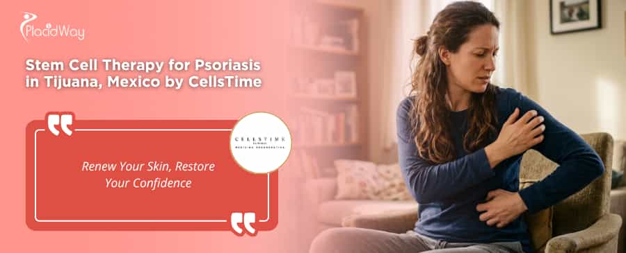 Stem Cell Therapy for Psoriasis in Tijuana Mexico at CellsTime