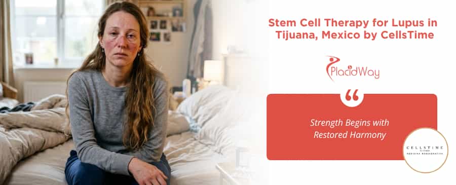 Stem Cell Therapy for Lupus in Tijuana Mexico at CellsTime Clinique
