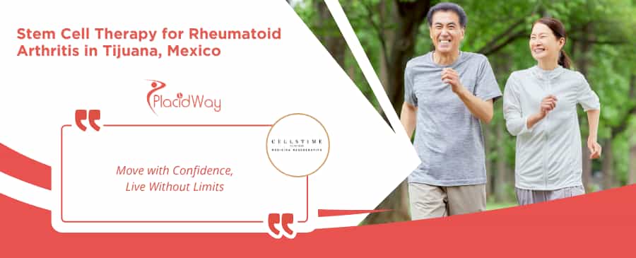 Terapia con células madre para la artritis reumatoide en Tijuana, México, en CellsTime Clinique.