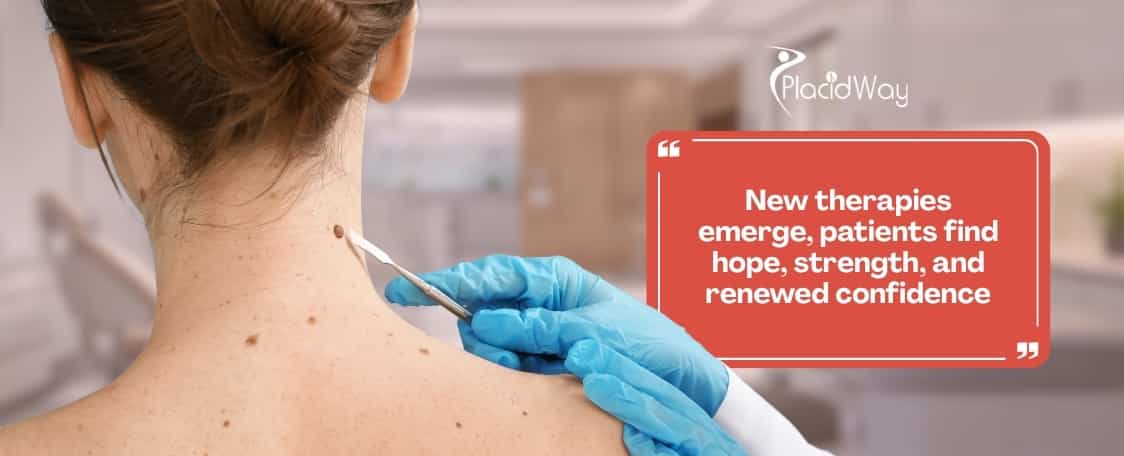 What Advanced Alternative Skin Cancer Therapies in Mexico Are Giving Canadians Hope?