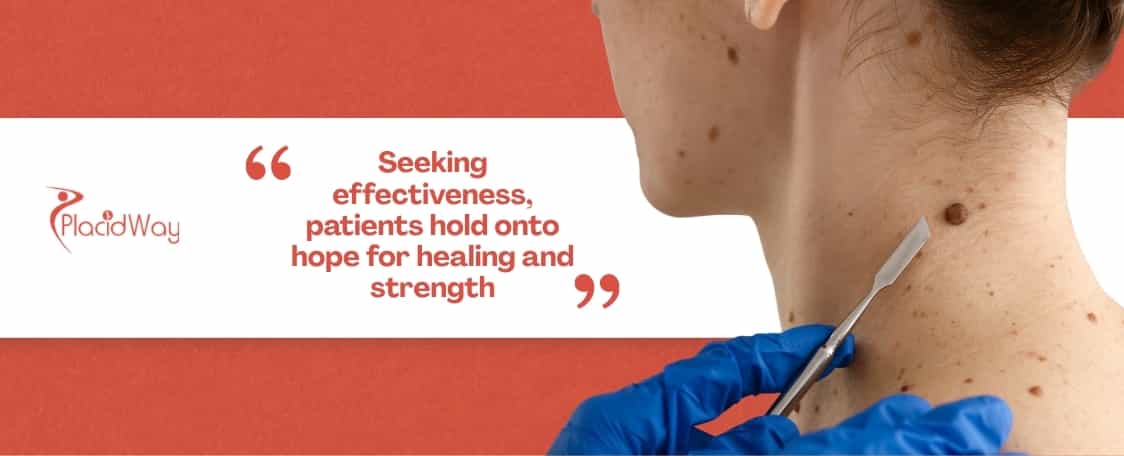 How Effective Are Alternative Treatments for Squamous Cell Carcinoma in Mexico for US Patients?