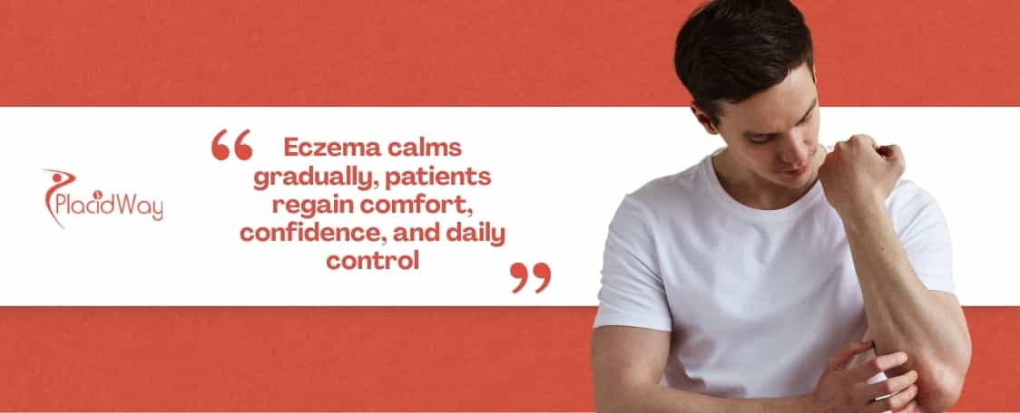 How Are US Sufferers Using Immune-Balancing Clinics in Tijuana to Reclaim Control Over Eczema?