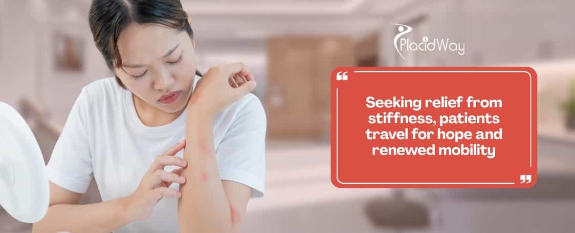 Why Are U.S. Scleroderma Patients Traveling to Tijuana for Stem Cell Therapy?