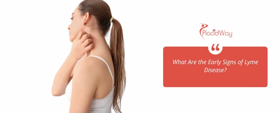 Women with rash due to lyme disease