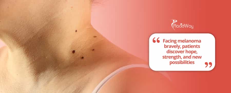 Melanoma Treatment Solutions: How U.S. Patients Are Finding New Hope in Mexico’s Clinics