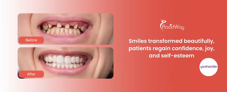 Transform Your Smile