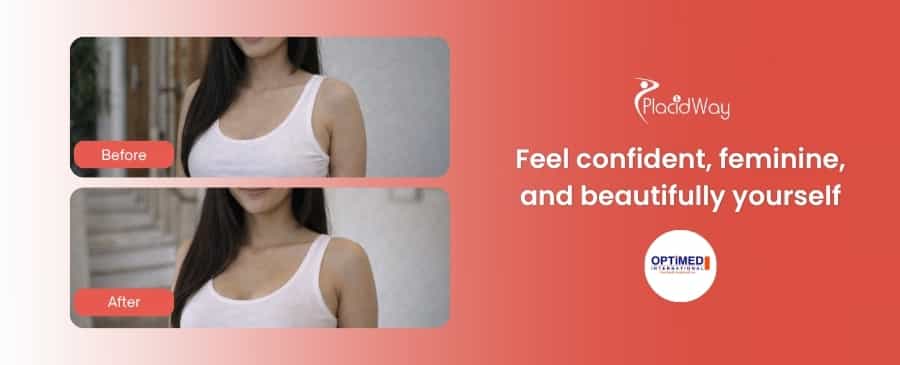 Aumento de senos en Turquía