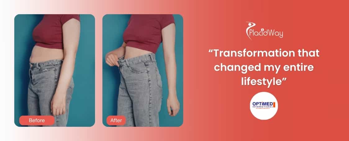 Хирургическое лечение ожирения в Турции