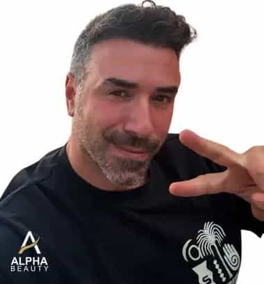 Hair Transplant Surgeon in Germany - Dr. Bilal Elbey