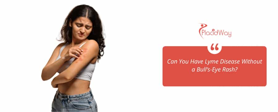 Women skin aches due to lyme disease