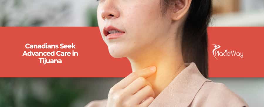 Thyroid Cancer Breakthroughs: How Canadians Are Turning to Tijuana for Life-Changing Treatment