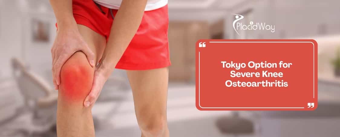 Is stem cell therapy in Tokyo a permanent alternative to knee replacement surgery for severe osteoarthritis