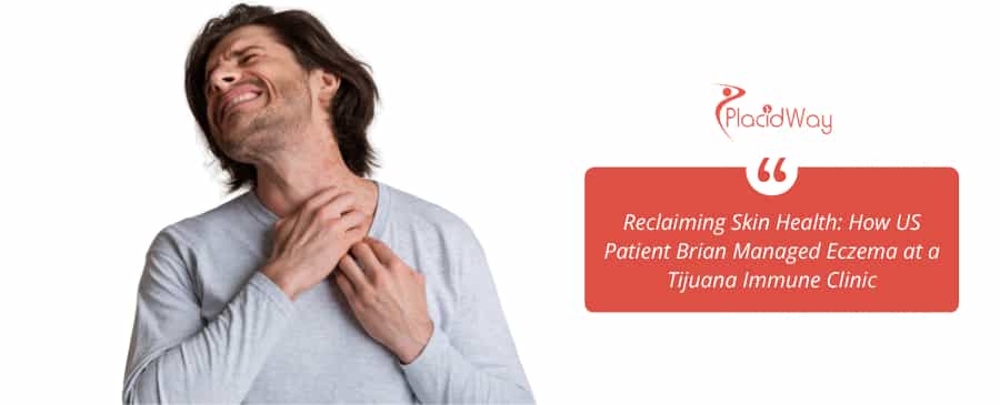 Brain with Eczema symtoms