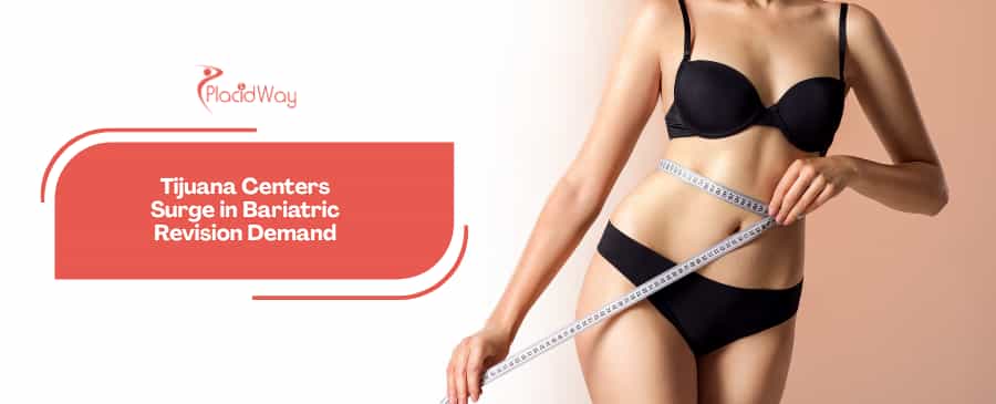 Fixing the Past: Why Tijuana Specialty Centers Are Seeing Record Growth in Complex Bariatric Revision Surgeries for U.S. Patients