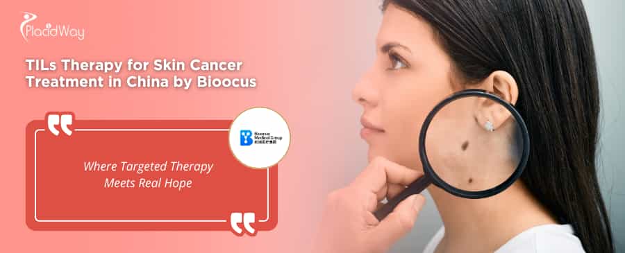 Терапия TIL-препаратами для лечения рака кожи в Пекине, Китай, в компании Bioocus Biotech.