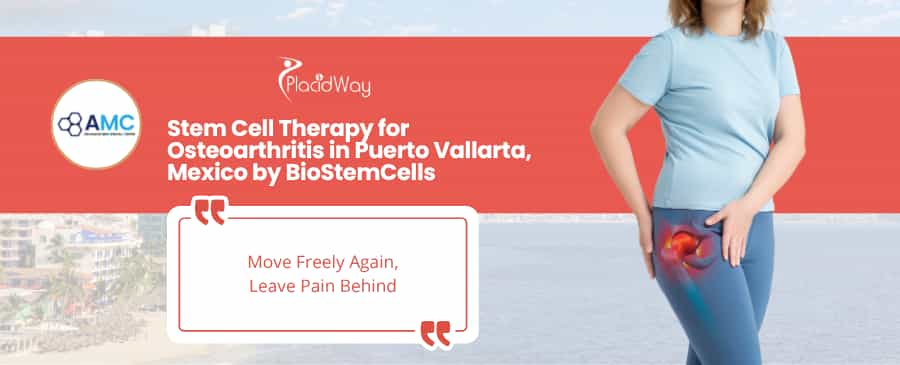 Stem Cell Therapy for Osteoarthritis in Puerto Vallarta Mexico by BioStemCells