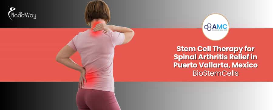 Stem Cell Therapy for Spinal Arthritis in Puerto Vallarta Mexico at BioStemCells
